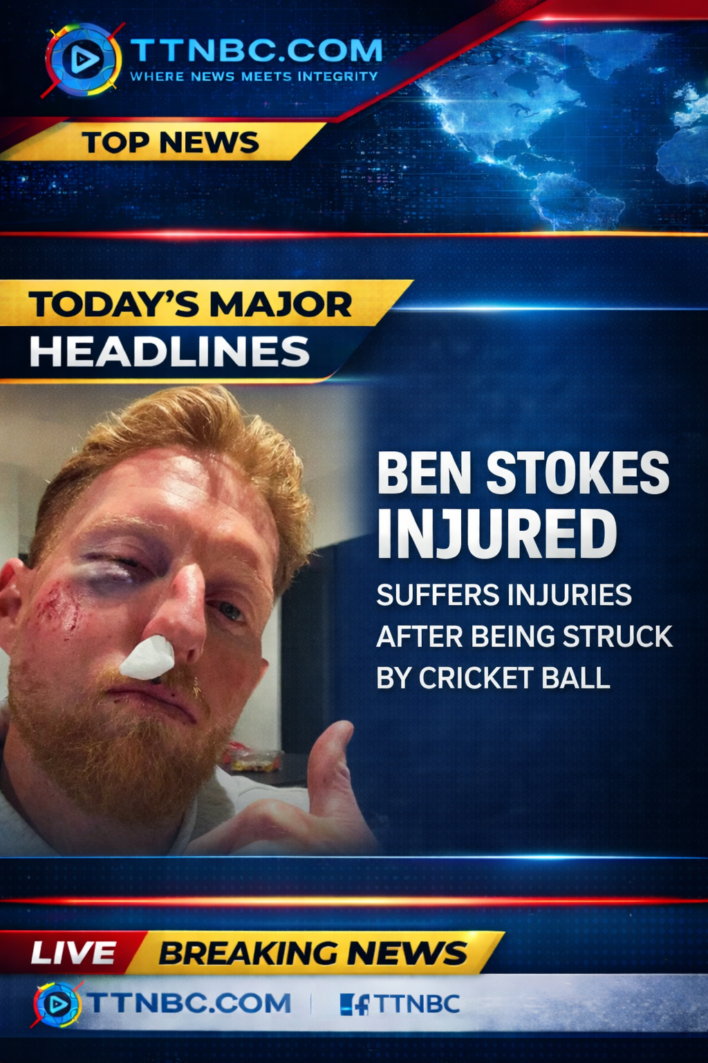 Ben Stokes Face Injury